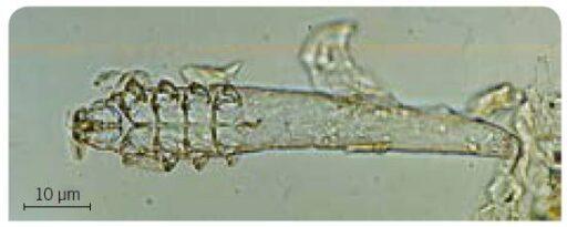 Demodex canis 