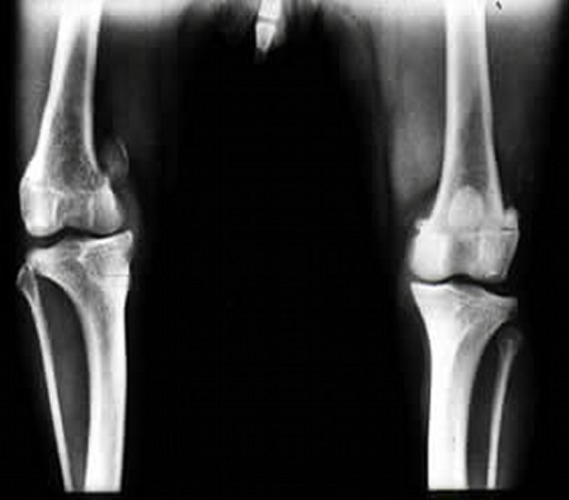 Radiografia de joelho de cão mostrando luxação patelar medial
