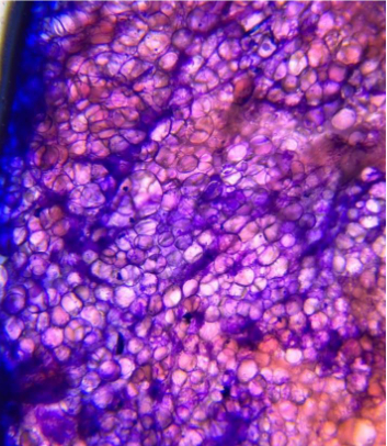 Citologia aspirativa sugestiva de lipoma em c&atilde;es