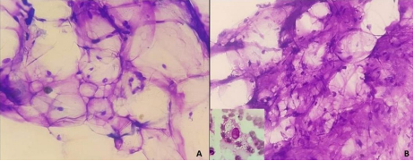 Exame mostra lipoma em c&atilde;o