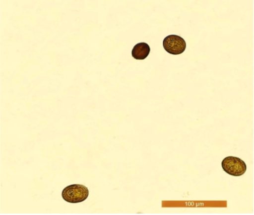 O exame coproparasitol&oacute;gico com m&eacute;todo de sedimenta&ccedil;&atilde;o para pesquisa de ovos pesados &eacute; considerado o padr&atilde;o-ouro para o diagn&oacute;stico da platinosomose