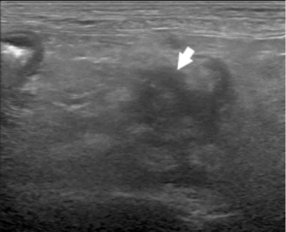 Ultrassonografia abdominal de um c&atilde;o com altera&ccedil;&atilde;o no p&acirc;ncreas