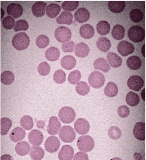 Imagem de Mycoplasma spp vista em um microscópio